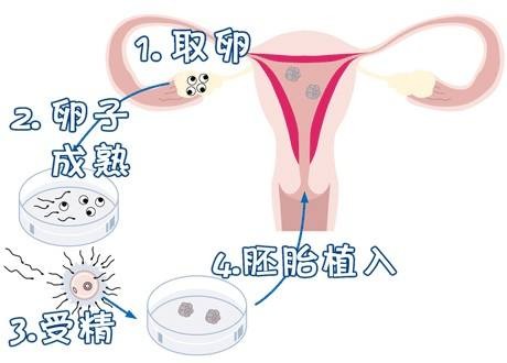 单基因病案例